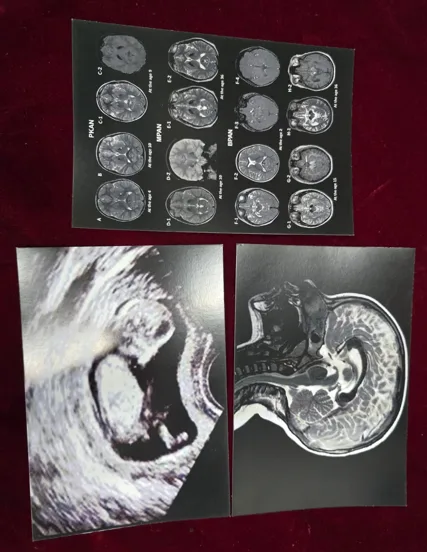 SCAN REPORT